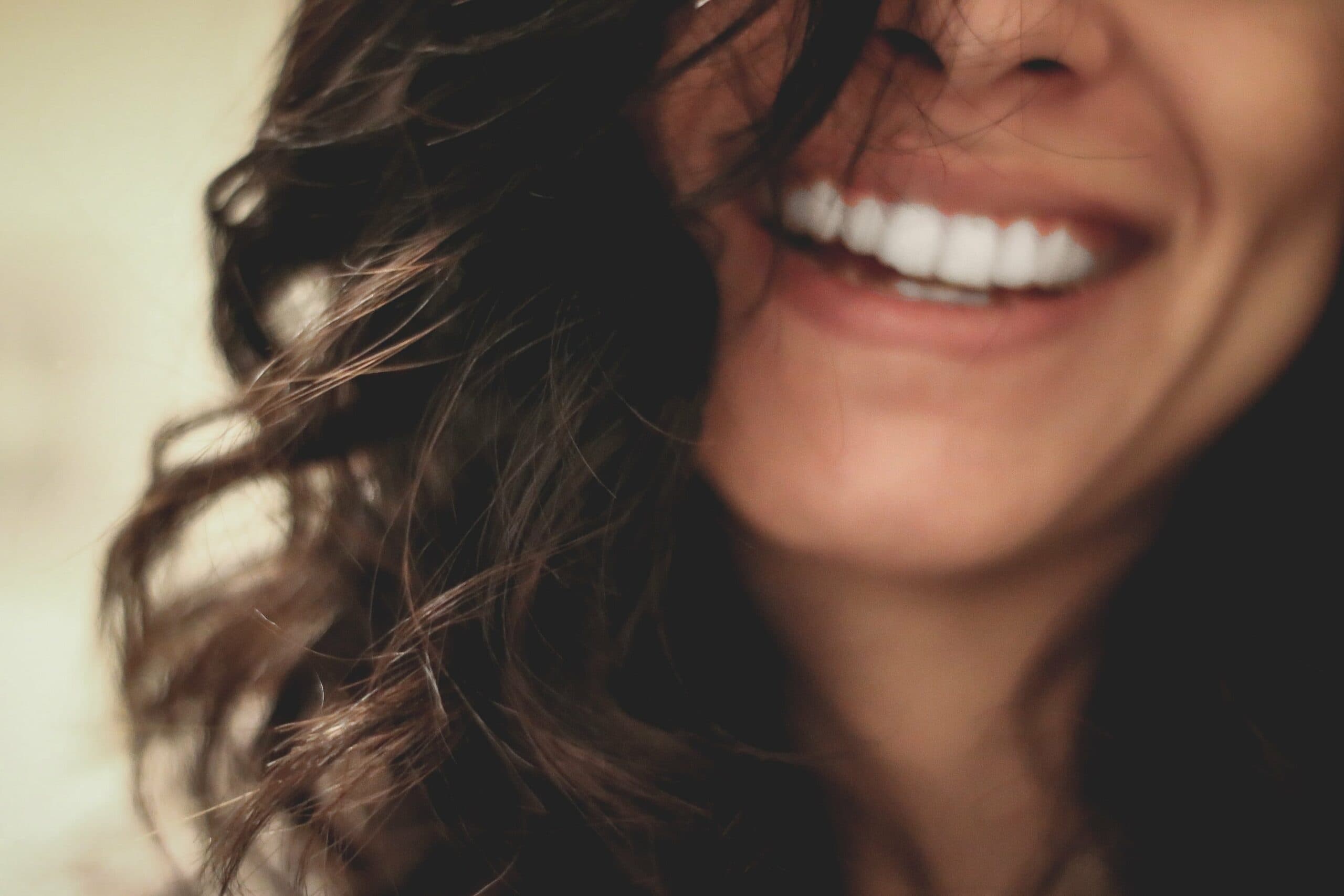 Hollywood smile veneer case at The Dentist in Dubai